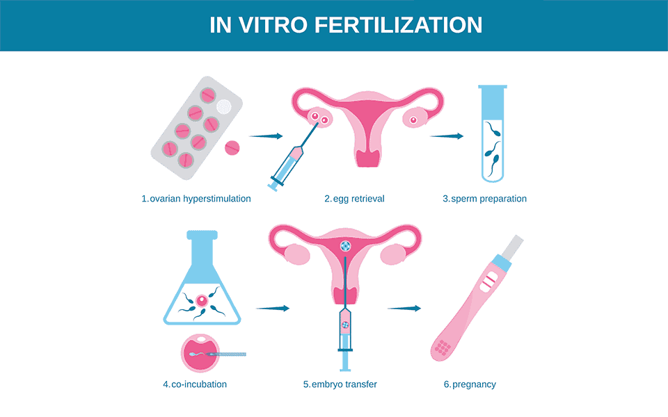 North Cyprus IVF Center IVF With ICSI